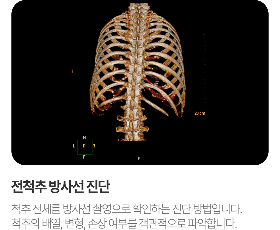 전척추방사선진단